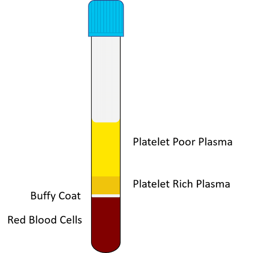 how to prepare prp